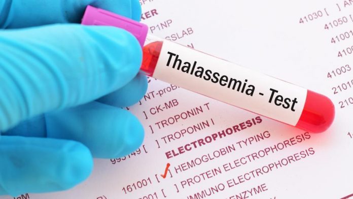 هل مرض الثلاسيميا خطير