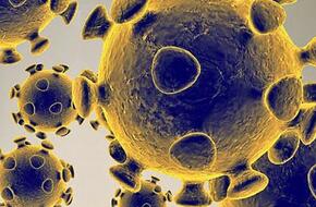 السعودية : حالتا وفاة و602 إصابة جديدة بفيروس كورونا | موقع السلطة