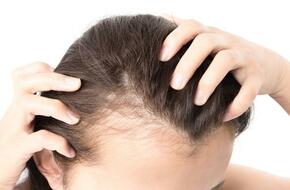 علاج انسداد بصيلات الشعر.. طرق طبية ومنزلية | المرأة والصحة | الصباح العربي