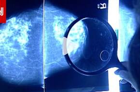 FDA توافق على أول علاج موجه لنوع جديد من سرطان الثدي