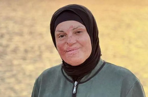جميلة الوجه رغم الأحقاد.. رحلة علاج إسراء جعابيص بعد تحررها من سجون إسرائيل