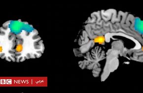 الذكاء الاصطناعي يساعد في خلق "أمل جديد" لعلاج الصدمات النفسية في مرحلة الطفولة - BBC News عربي