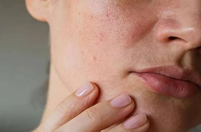 احذر تأثير تقلبات الطقس على بشرتك.. 5 نصائح لعلاج حكة الجلد
