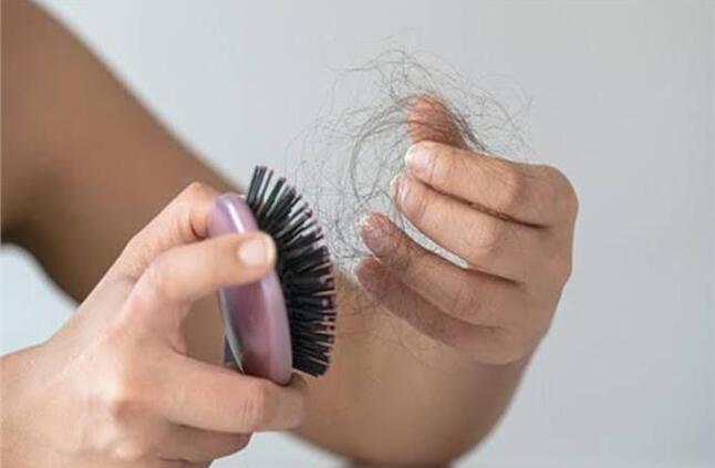 4 أسباب خطيرة تسبب تساقط الشعر