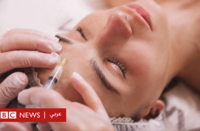 الإيدز: هل تؤدي عمليات تجميل الوجه إلى الإصابة بفيروس نقص المناعة المكتسب؟  - BBC News عربي