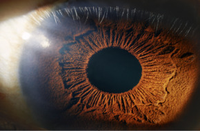 علامات في العين قد تدل على أمراض مزمنة